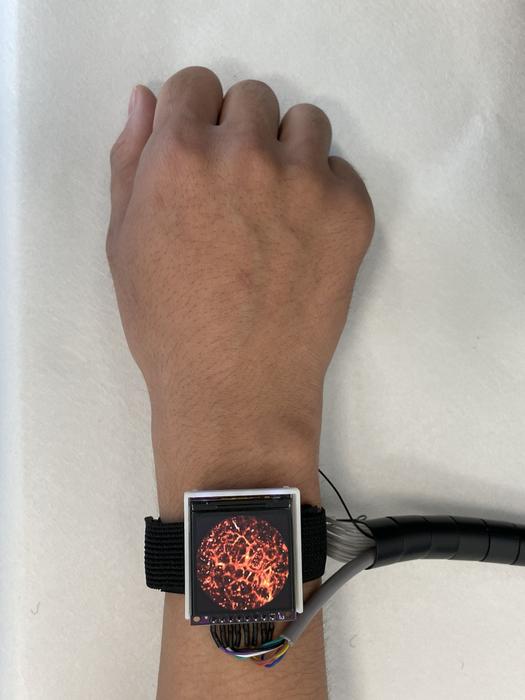 Imagen: El reloj de imágenes fotoacústicas puede adquirir imágenes de alta resolución de los vasos sanguíneos en la piel (Fotografía cortesía de Lei Xi)